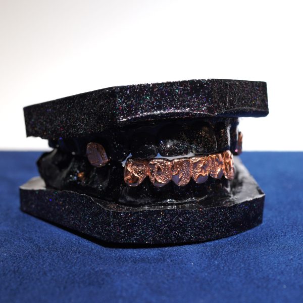 nugget VVS Grillz , Diamond Dancing Grillz