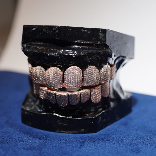 8 on 8 rose-gold Grillz Diamond Dancing grillz fully iced with VVS