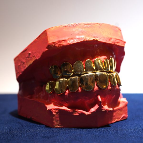 8 on 8 Custom Grillz Diamond Dancing