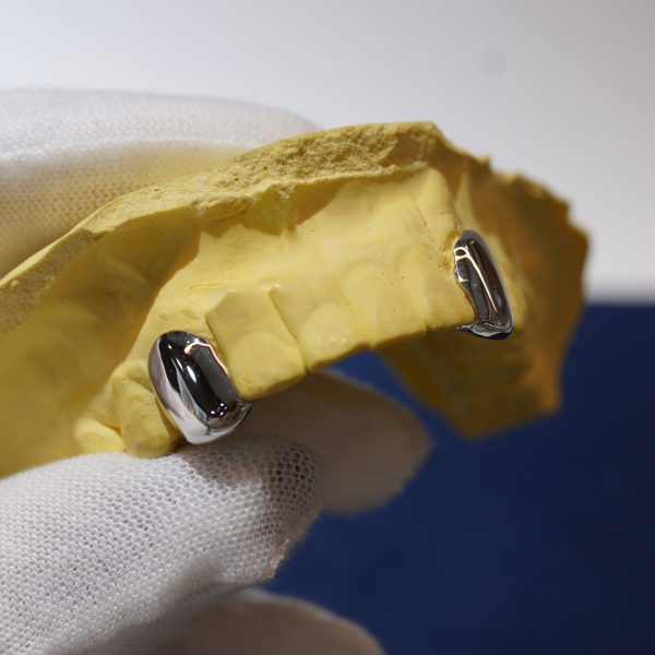 Diamond dancing top custom iced-out grillz