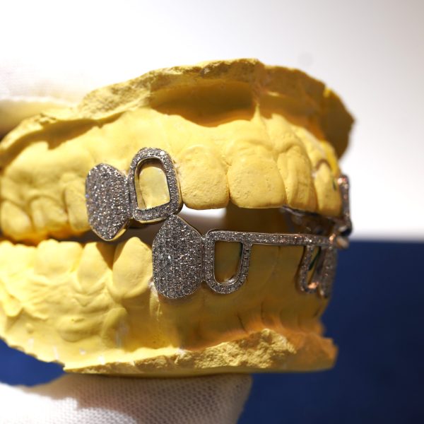 A custom top and bottom open face diamond grillz