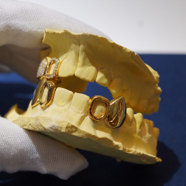 A custom open face grillz set Diamond Dancing