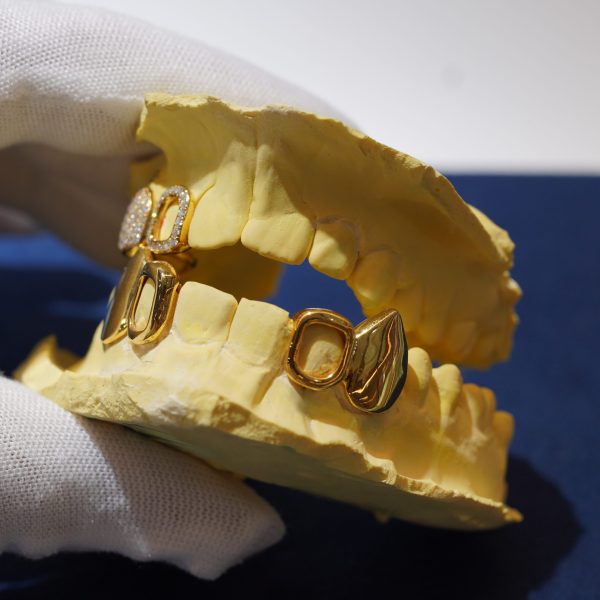 A custom open face grillz set Diamond Dancing