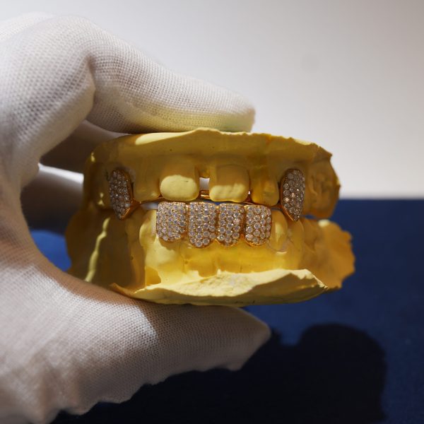 Diamond dancing top and bottom custom iced-out grillz set