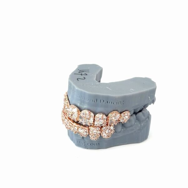 mix stone grillz
